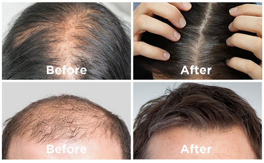 hair revital x User Results